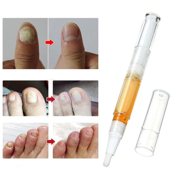 Magic Nail Repair Pen